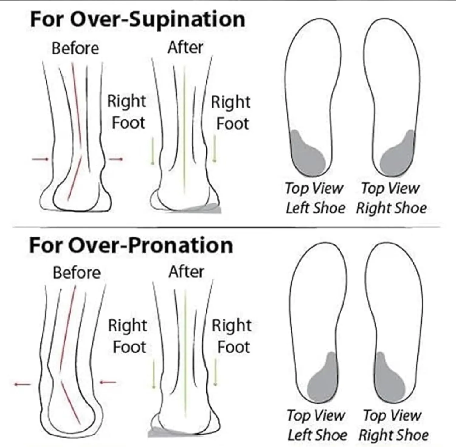 Women's Soft Sole Mesh Comfort Orthopedic Shoes, Comfortable Walking Shoes Women Arch Support, Low-top Flat Arch Support Walking Shoes, Casual Slip-on Shoes